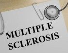 Nuovi sviluppi nella ricerca sulla sclerosi multipla