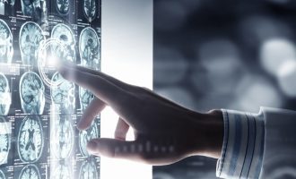L’uso delle tecniche di neuroimmagine nella scelta del trattamento della depressione