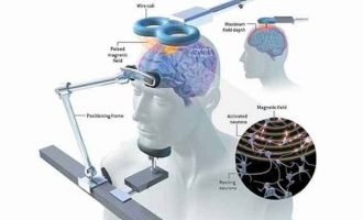 La stimolazione magnetica transcranica (TMS) – Introduzione alla Psicologia La stimolazione magnetica transcranica (TMS) – Introduzione alla Psicologia