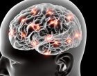 Elettroencefalografia (EEG): caratteristiche e modalità di funzionamento – Introduzione alla Psicologia