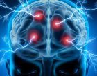 L’utilizzo di tecniche di neurostimolazione nel trattamento dei disturbi psichiatrici