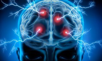 L’utilizzo di tecniche di neurostimolazione nel trattamento dei disturbi psichiatrici
