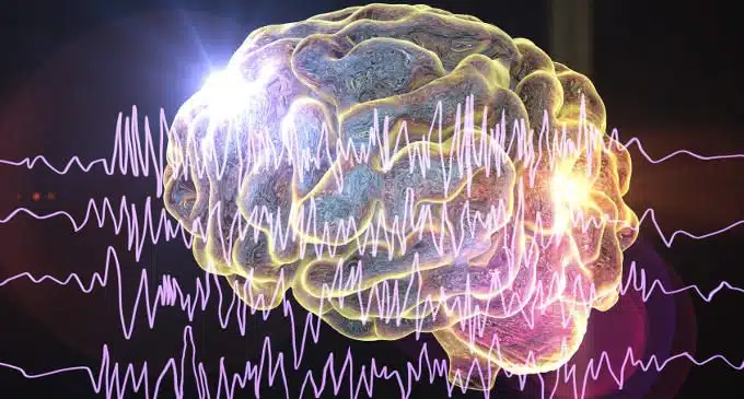 Epilessia: un dispositivo elettronico cerebrale per fermare le convulsioni