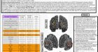 Le basi neurobiologiche dell’anoressia nervosa: è tutta una questione di Attaccamento?