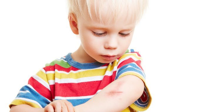 Il dolore nei bambini e le strategie psicopedagogiche d’intervento