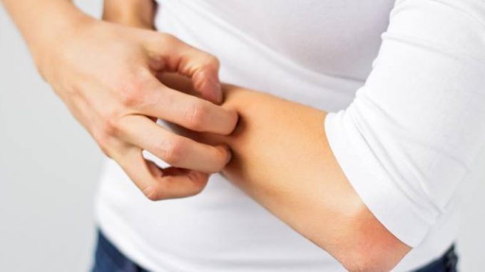 Dermatillomania: tormentarsi la pelle per noia o frustrazione