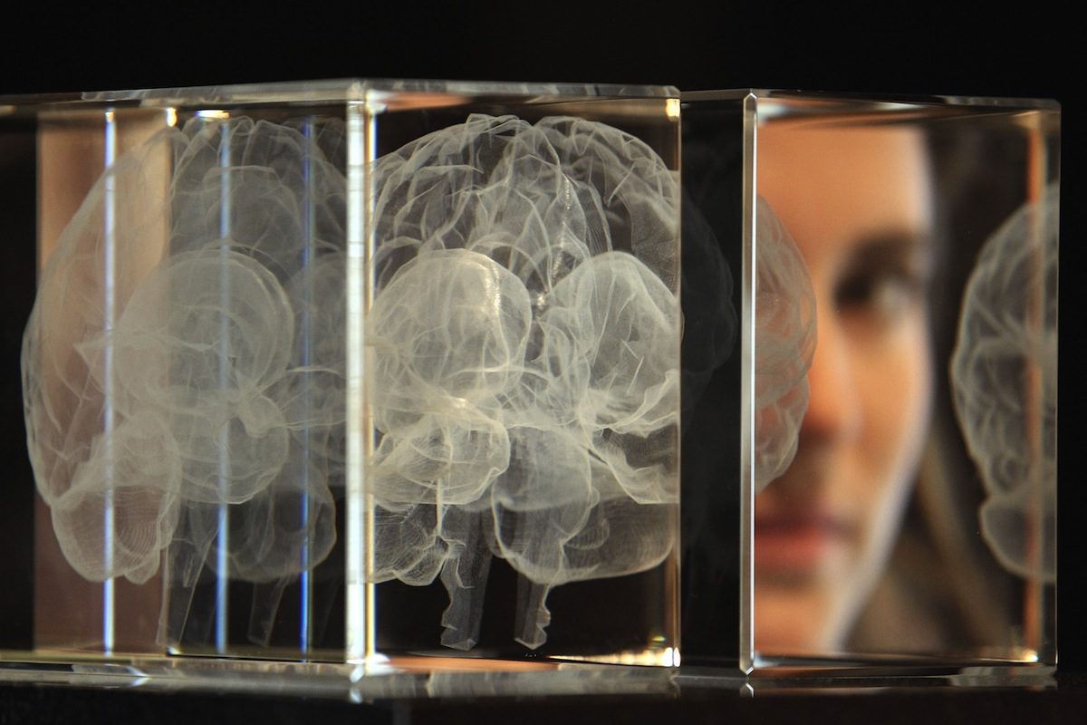 Morbo di Parkinson la stimolazione cerebrale profonda
