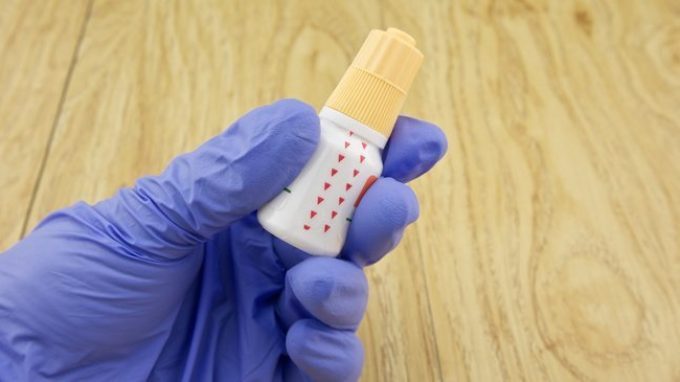 Un collirio per contrastare le malattie neurodegenerative?