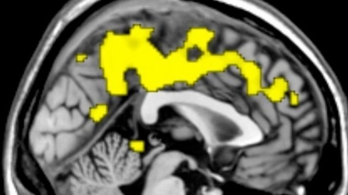 Il metodo caotico per interpretare le risonanze: sfruttare il caos per capire il cervello umano