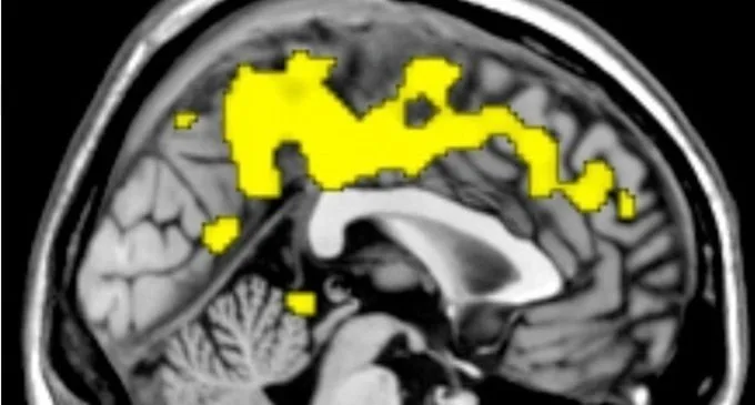 Il metodo caotico per interpretare le risonanze sfruttare il caos per capire il cervello umano