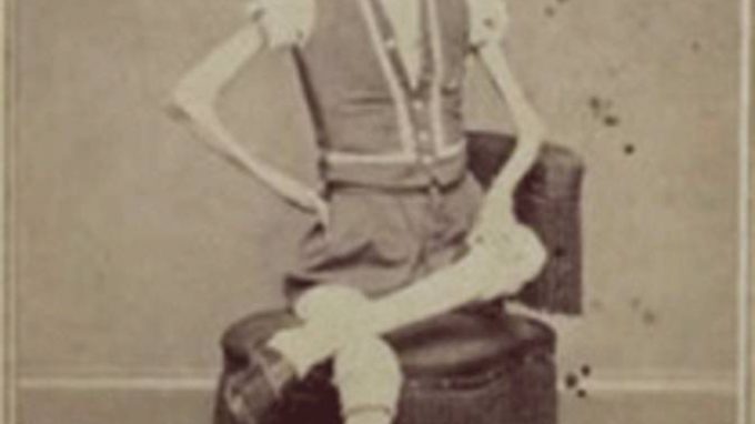 Il digiunatore da circo del cinquecento – Storia dei disturbi alimentari
