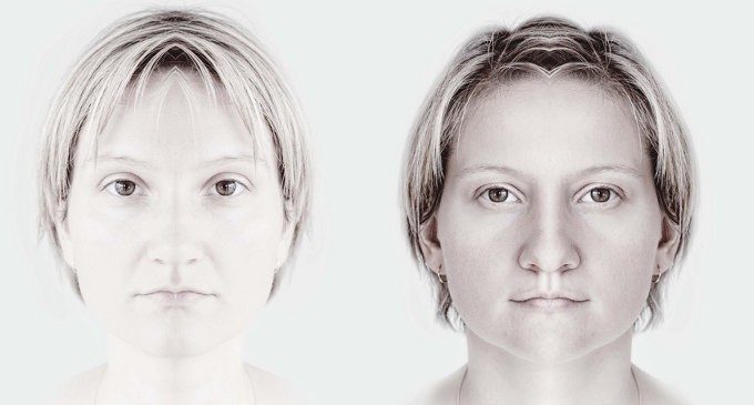 L’asimmetria di un’emozione: un’emiparesi facciale rende difficile il riconoscimento delle emozioni altrui