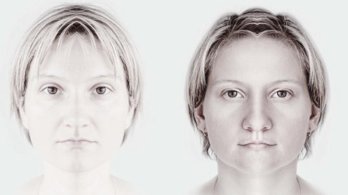 L’asimmetria di un’emozione: un’emiparesi facciale rende difficile il riconoscimento delle emozioni altrui