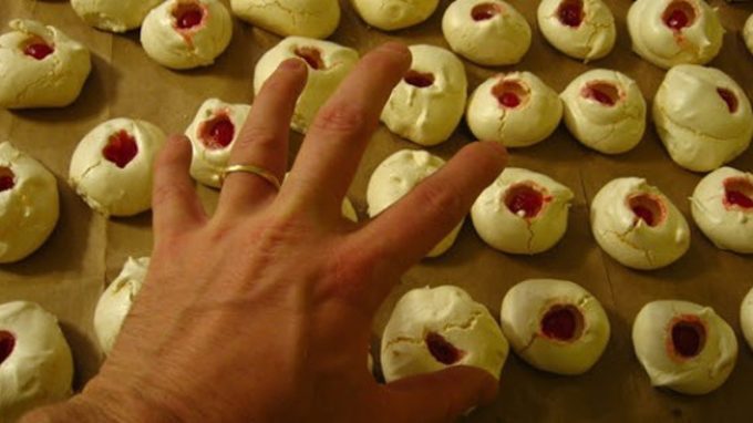 “Ehi, hai mangiato dal mio piatto!”: comportamenti alimentari alterati nella demenza frontotemporale