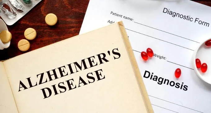 L’intelligenza artificiale può aiutare nella diagnosi di Alzheimer