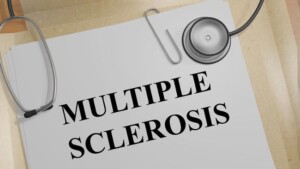 Ricerche nel campo della sclerosi multipla: scoperto un gene