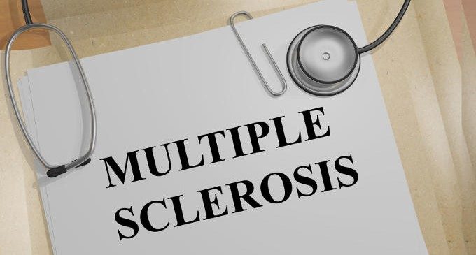 Nuovi sviluppi nella ricerca sulla sclerosi multipla