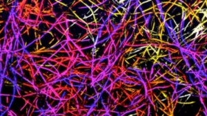 Un ponte di carbonio fra tessuti nervosi - Una spugna hightech connette i neuroni in vitro (ed è biocompatibile in vivo)