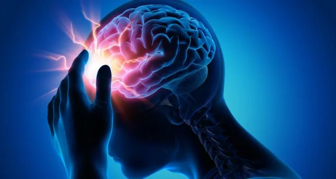 Epilessia: scoperta una nuova cura per prevenire le crisi epilettiche