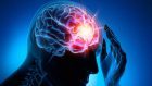 Utilizzo della cannabis per uso terapeutico nelle epilessie farmaco-resistenti: l’individuazione di una nuova molecola con attività antiepilettica