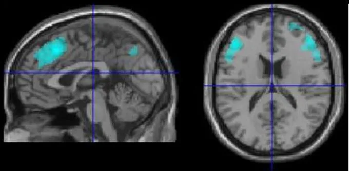 Valore atteso e rischio nel processo decisionale quali i correlati neuronali_FIGURA 5