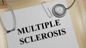 Sclerosi multipla: il trattamento dei sintomi cognitivi con la tDCS