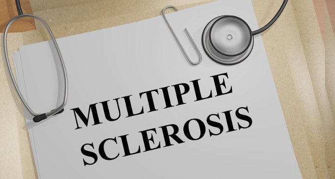 La tDCS nel trattamento dei sintomi cognitivi dei pazienti con Sclerosi Multipla