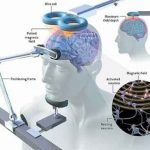 La stimolazione magnetica transcranica TMS - Introduzione alla psicologia