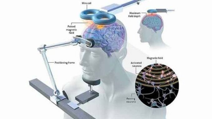 La stimolazione magnetica transcranica (TMS) – Introduzione alla Psicologia