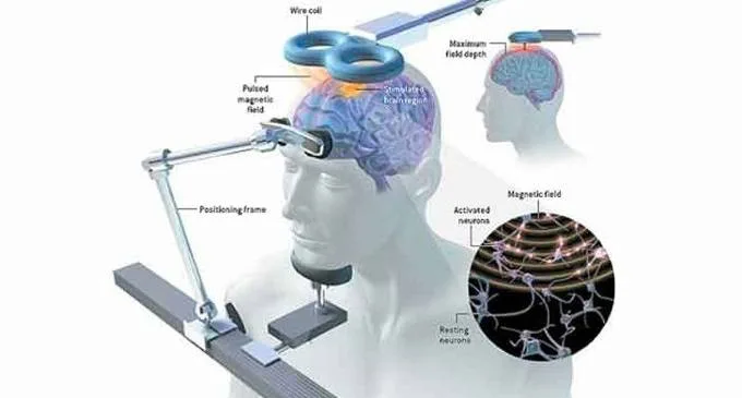 La stimolazione magnetica transcranica TMS - Introduzione alla psicologia