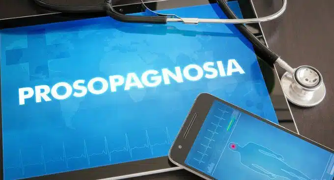 Prosopagnosia congenita e acquisita gli effetti della patologia a livello psicosociale