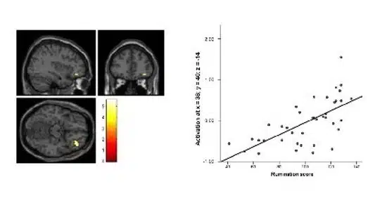 Ruminazione in caso di Disturbo da Stress Post Traumatico quali i correlati neurali - IMM2