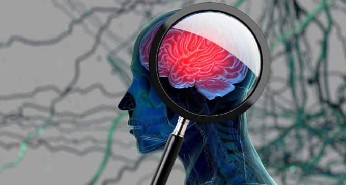 Demenze: lo studio delle proteine per sviluppare interventi di cura