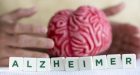 Lo sviluppo del morbo di Alzheimer: il dibattito è ancora aperto