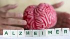 Lo sviluppo del morbo di Alzheimer: il dibattito è ancora aperto