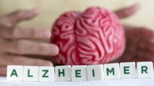 Morbo di Alzheimer: nuovi studi di imaging cerebrale sul suo sviluppo
