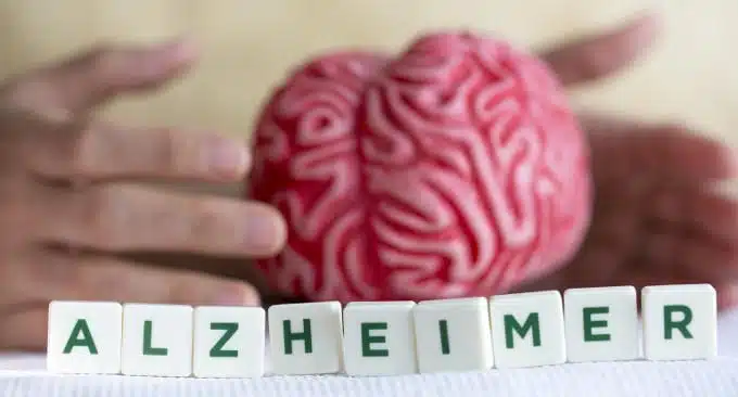 Morbo di Alzheimer: nuovi studi di imaging cerebrale sul suo sviluppo