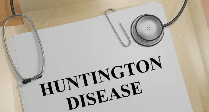 Malattia di Huntington: le nuove frontiere sulle origini e i trattamenti