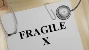 Sindrome dell' X Fragile: verso la diagnosi precoce, in età neonatale