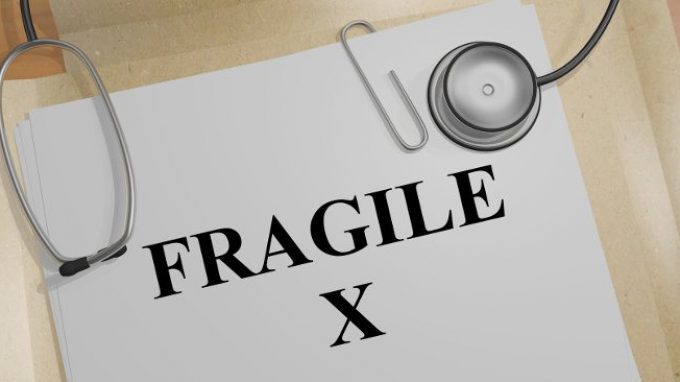 Sindrome dell’ X Fragile: grazie alla ricerca potrà essere possibile diagnosticarla in età neonatale