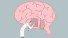 Scoperti particolari segmenti di DNA che causerebbero la morte dei neuroni nel Morbo di Alzheimer