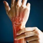 Malattie reumatiche: intolleranza dell'incertezza nella percezione del dolore