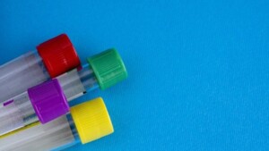 Ansia e Depressione: l'aiuto dei biomarker metabolici nella diagnosi