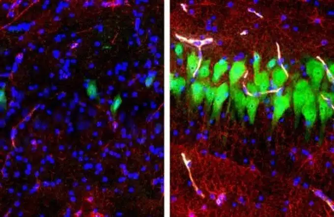 Resurrezione cerebrale il primo esperimento su cervelli di maiale img