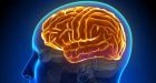 Trauma cranico: deficit cognitivi e comportamentali