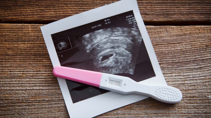 Coppie in PMA: aspetti psico-sessuologici della Procreazione Medicalmente Assistita