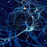 Parkinson e trattamento con Deep Brain Stimulation: vantaggi e svantaggi