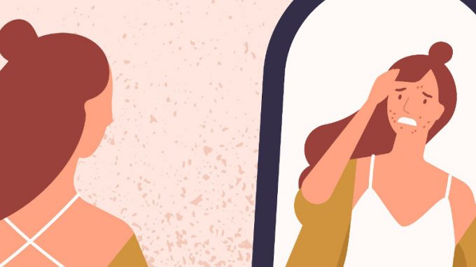 L’ acne in età adulta: un problema medico (ma non solo)