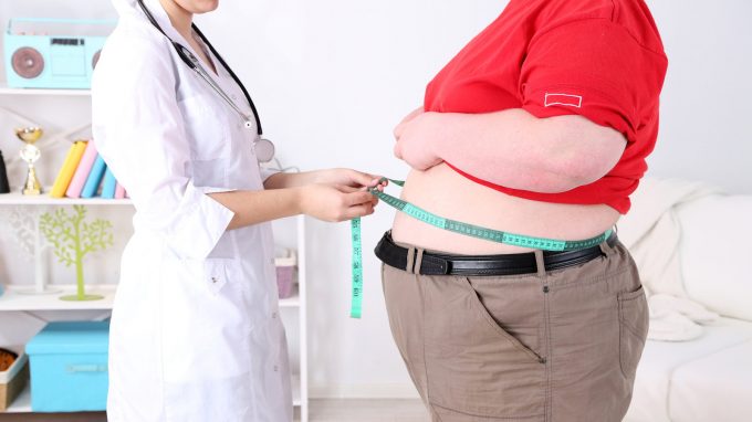 La Chirurgia Bariatrica funziona? Indagine con follow-up sugli effetti nel tempo dell’intervento di chirurgia bariatrica