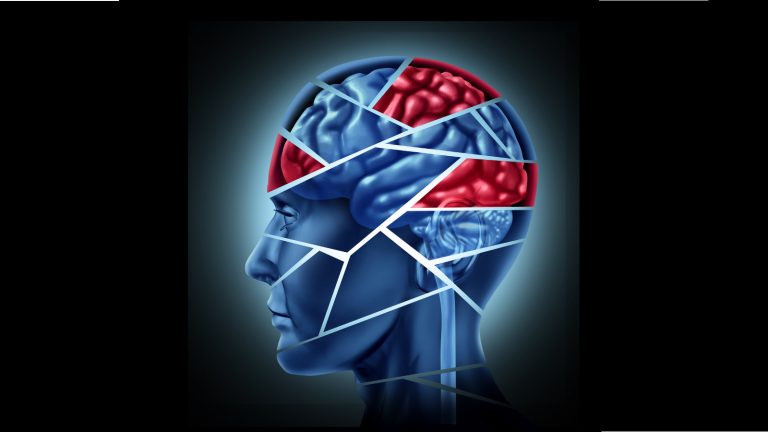 Trauma cranico encefalico (TCE): dal trauma alla riabilitazione